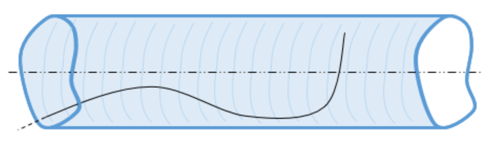 The hook of the guide wire in a blood vessel